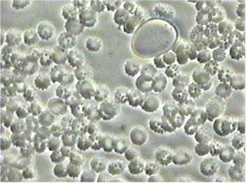 마이코플라즈마
