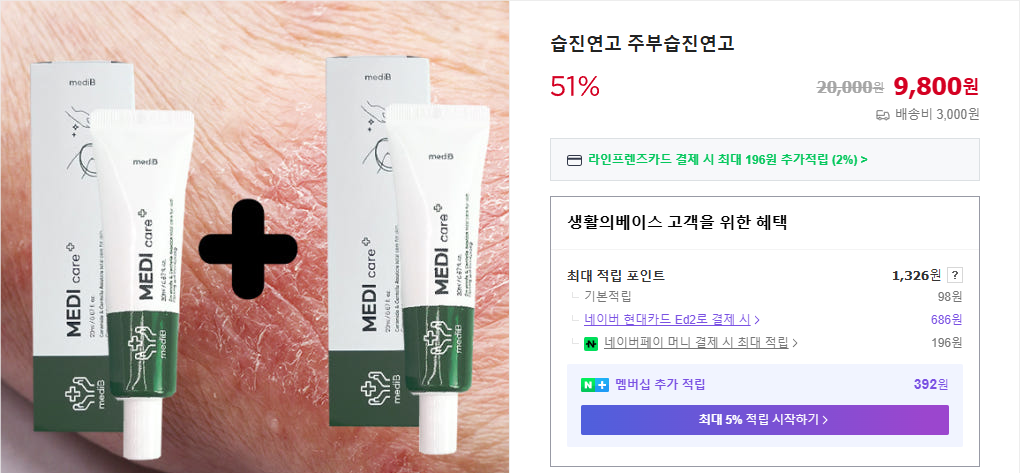 습진치료방법, 사타구니습진, 습진연고추천