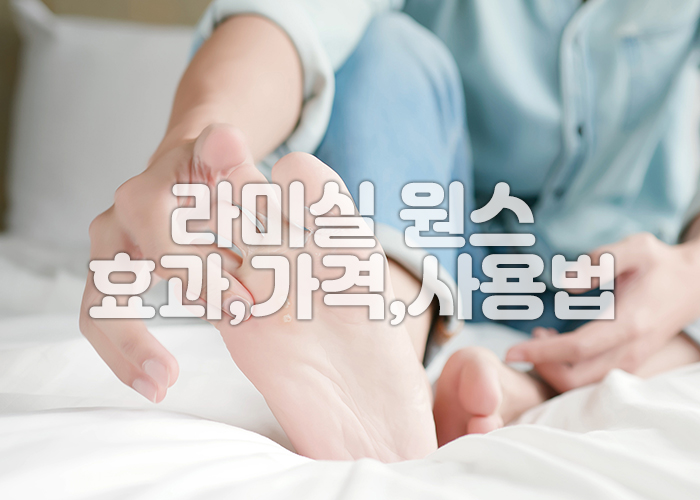 무좀이 있는 발에 무좀약을 바르고 있다