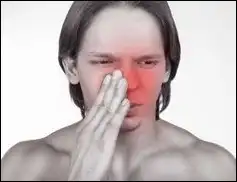 알레르기약&amp;#44; 증상별 약 알아보기