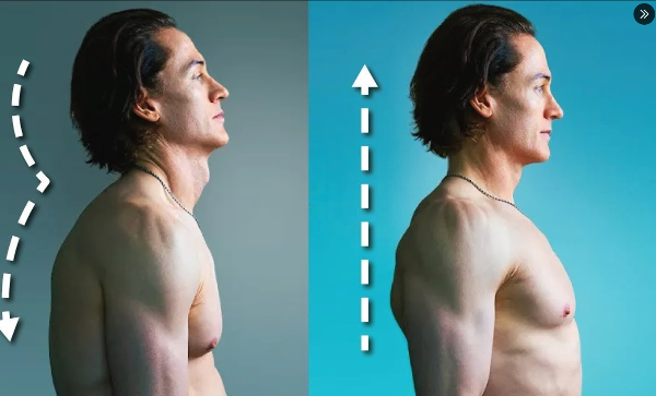 브라이언 존슨의 자세 교정