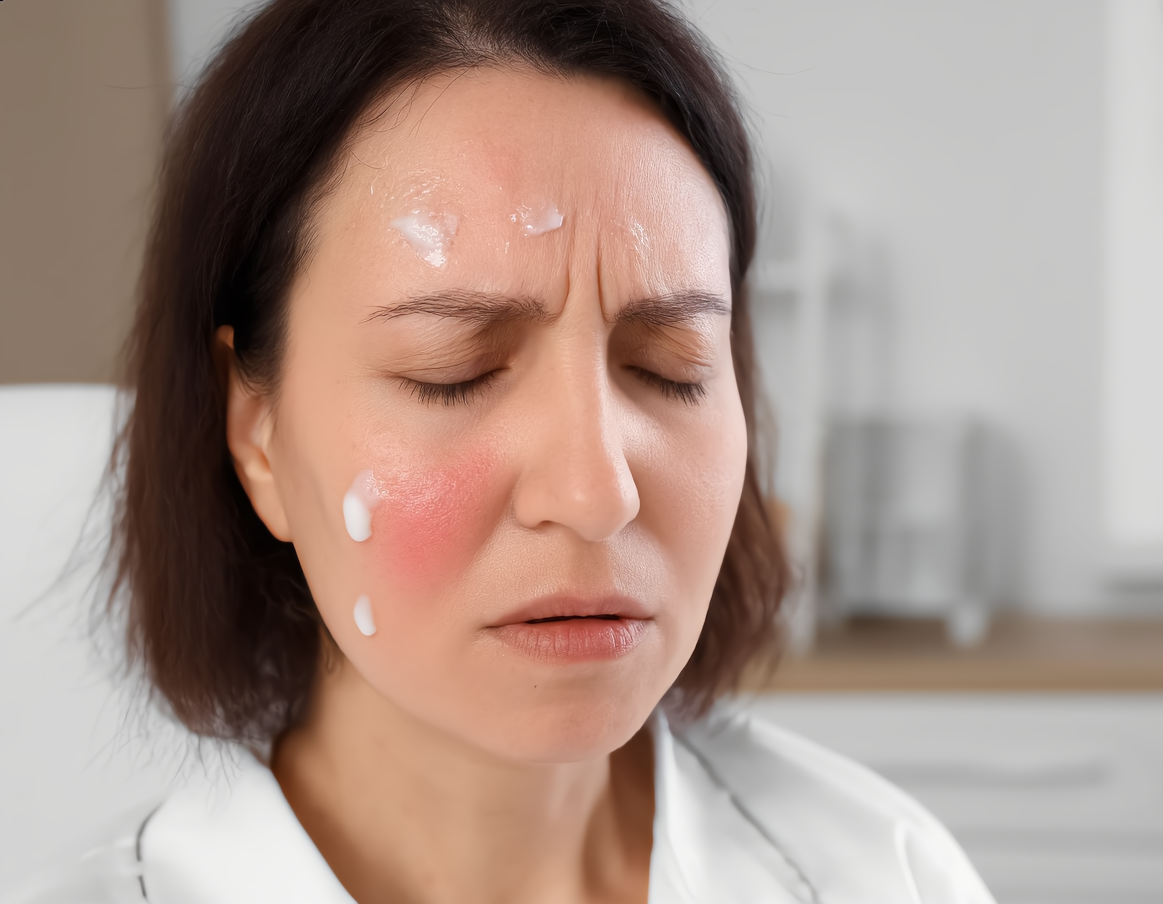 붉게 달아오른 볼이나 자극받아 보이는 피부 클로즈업>