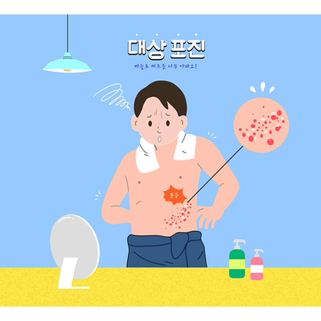 대상포진 이미지