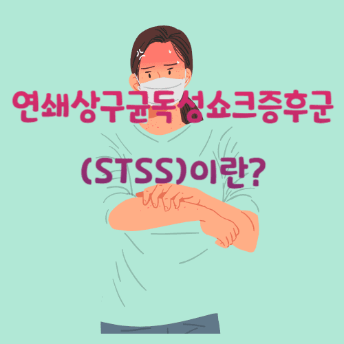 연쇄상구균독성쇼크증후군(STSS)이란?