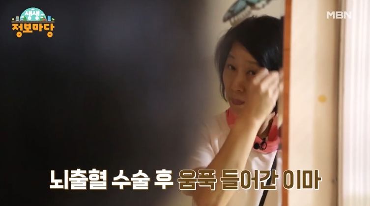 뷰티풀 맘마미아 뇌수술 후 움푹 들어간 이마 엄마 자신감 회복 주름 개선 시술 병원 신청 방법 안내