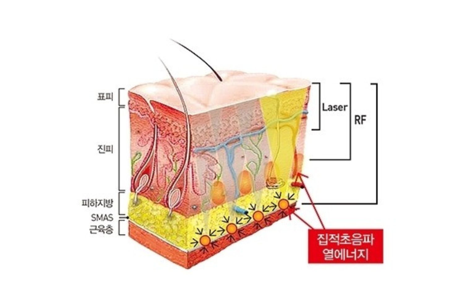 피부의 구조