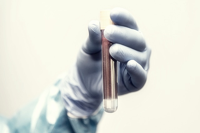 2025 대한민국 헌혈 공모전