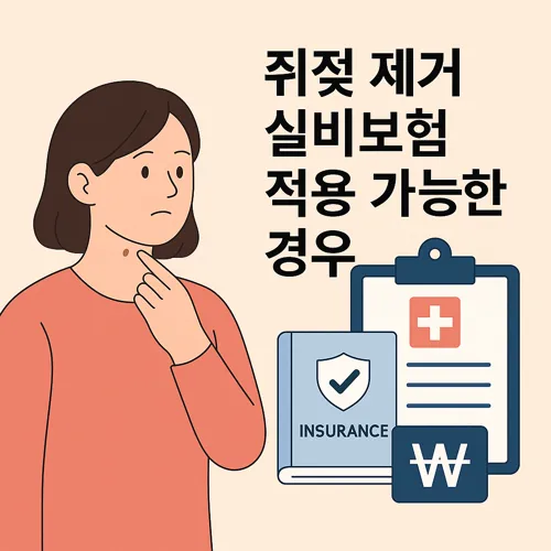 쥐젖 제거 실비보험 적용 가능한 경우 썸네일