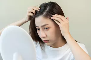 원형탈모-원인