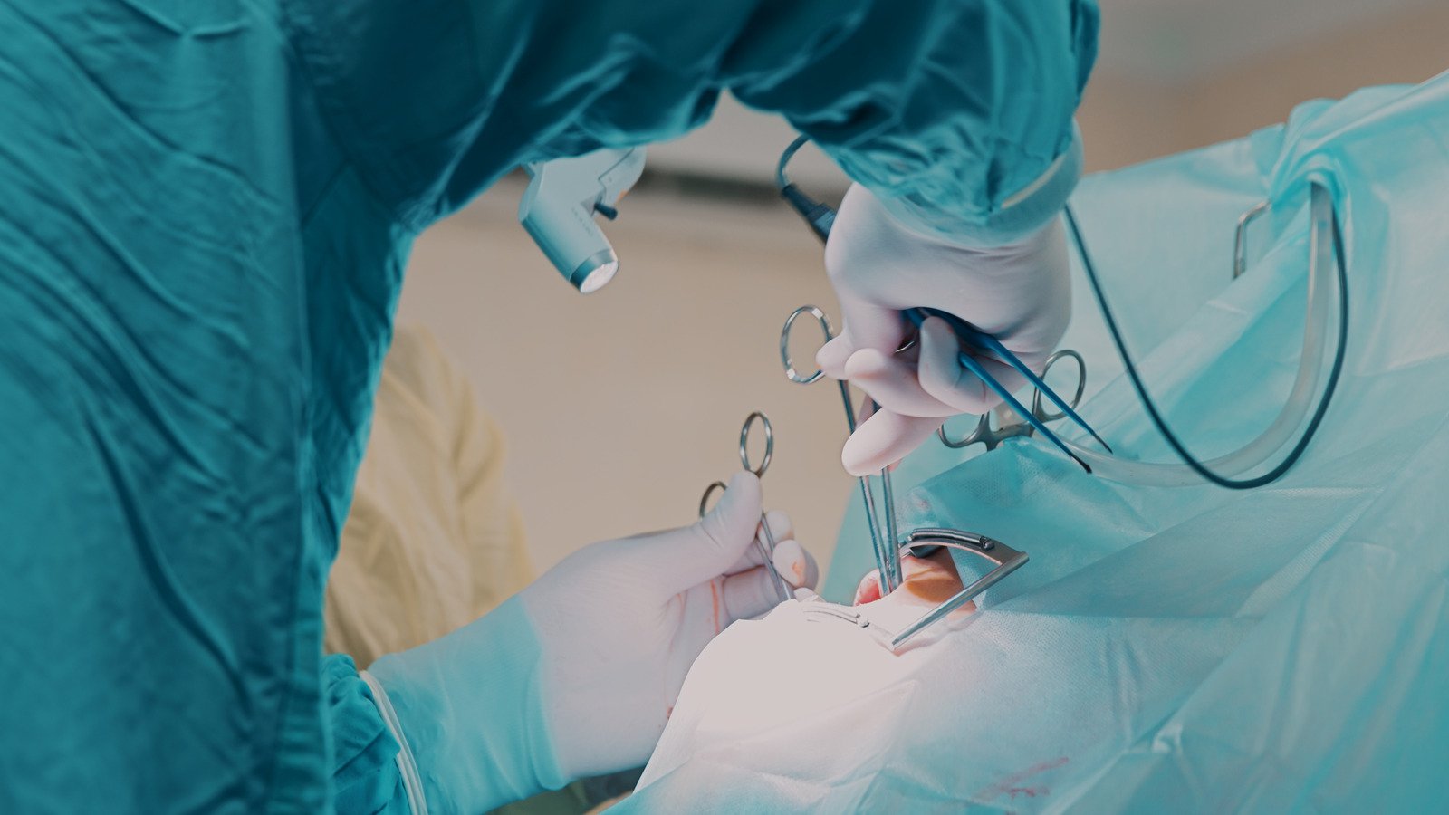 설근고정술 (Hyoid Suspension Surgery): 수면무호흡증 치료를 위한 수술