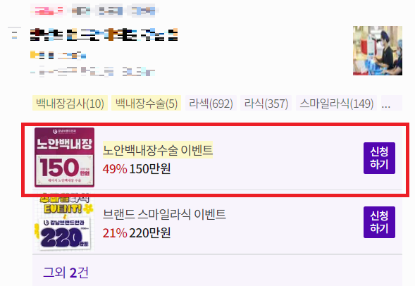 백내장 수술비용 사진