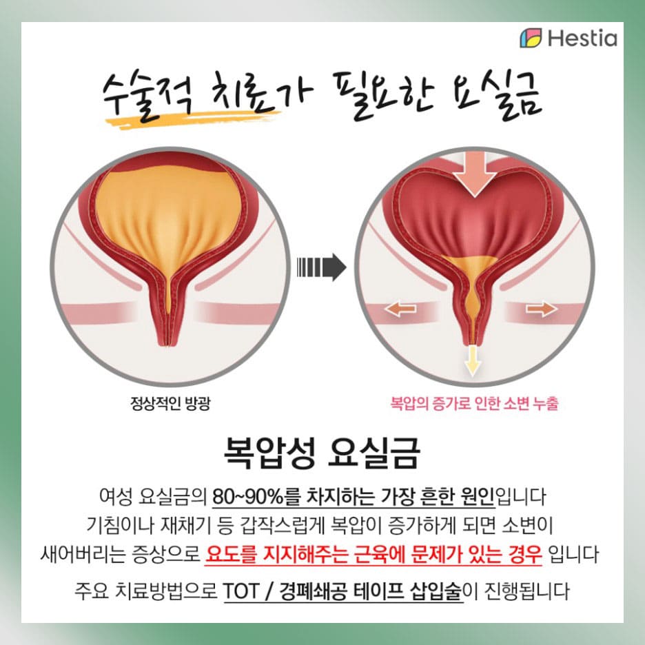 복압성요실금
요실금증상 요실금실비