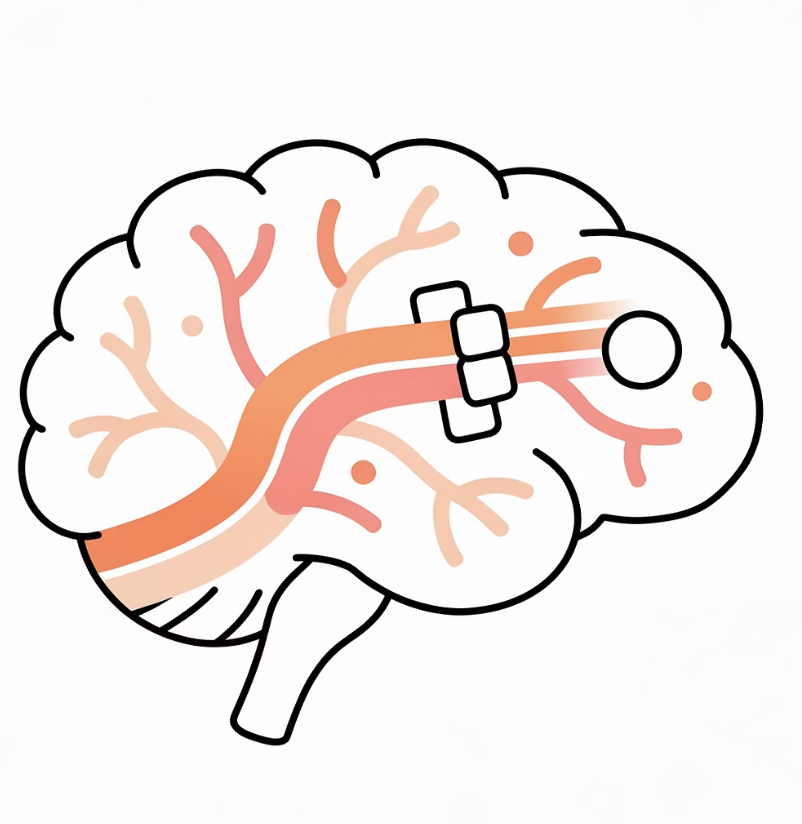 뇌졸중-전조증상-중요한-1분-뇌-인포그래픽