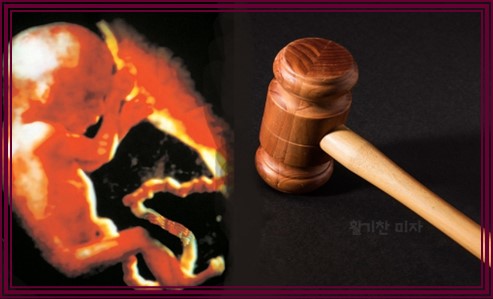 임신 중절 수술 시기