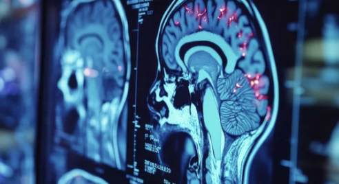 MRI 검사