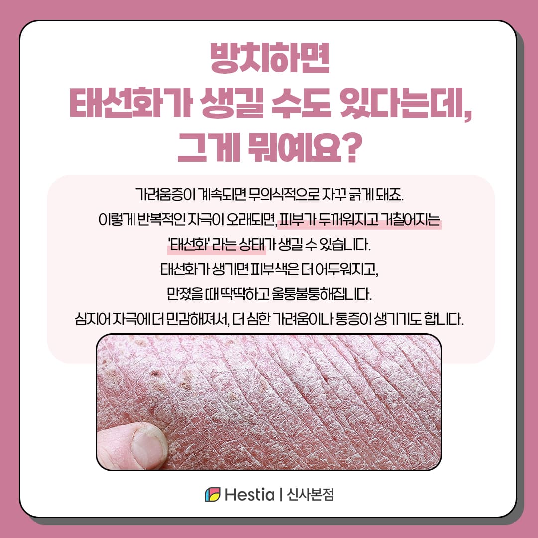 반복되는 외음부 간지러움, 외음부 착색 그냥 두면 더 심해질 수 있습니다.