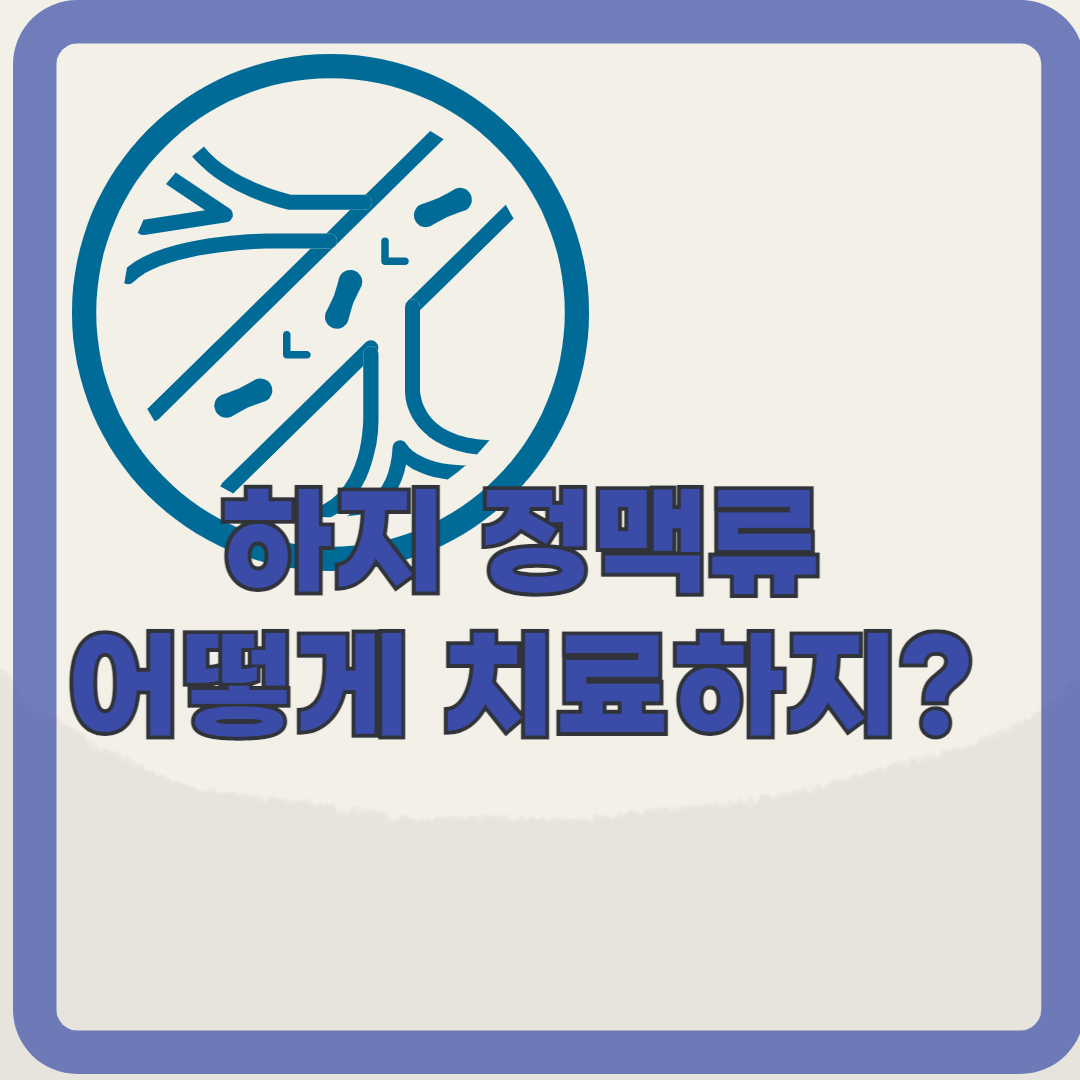하지정맥류 자가 체크 리스트, 혹시 나도 하지정맥류?