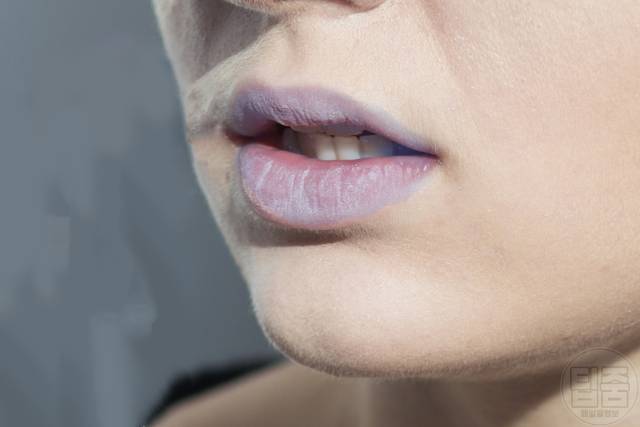 입술색 변화 청색증 빈혈