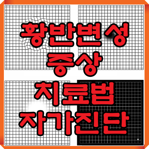 황반변성 증상 치료법 자가진단