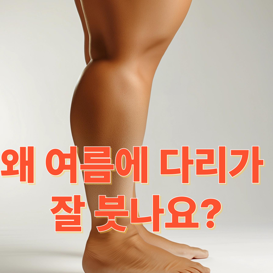 왜 여름에 다리가 잘 붓나요