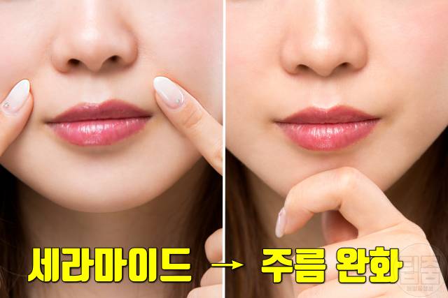 얼굴 건조 각질 세라마이드 효능 잔주름 제거
