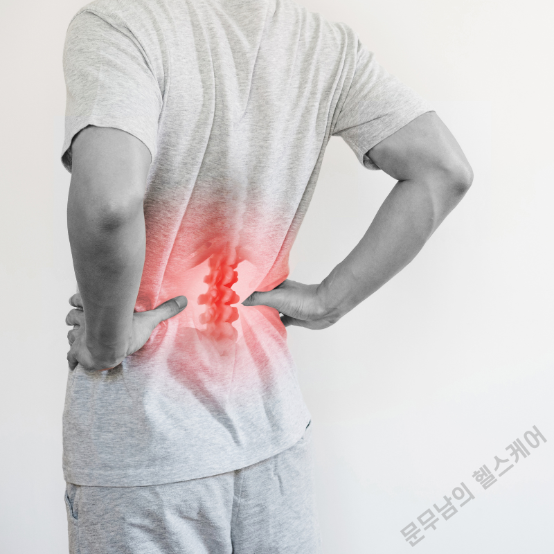 허리 삐끗했을 때, 요추 염좌 치료법