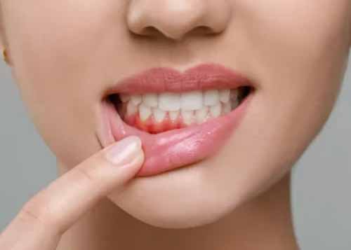 구강 건강 위한 AI 예측 기술과 양치 습관 혁신