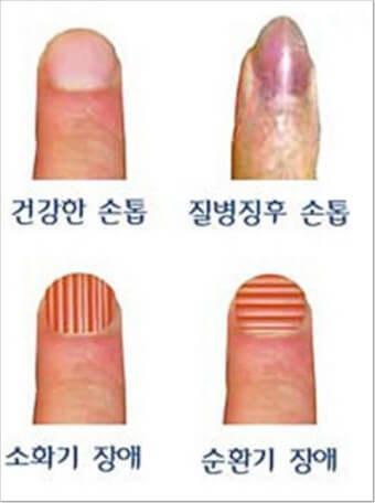 건강의 바로미터