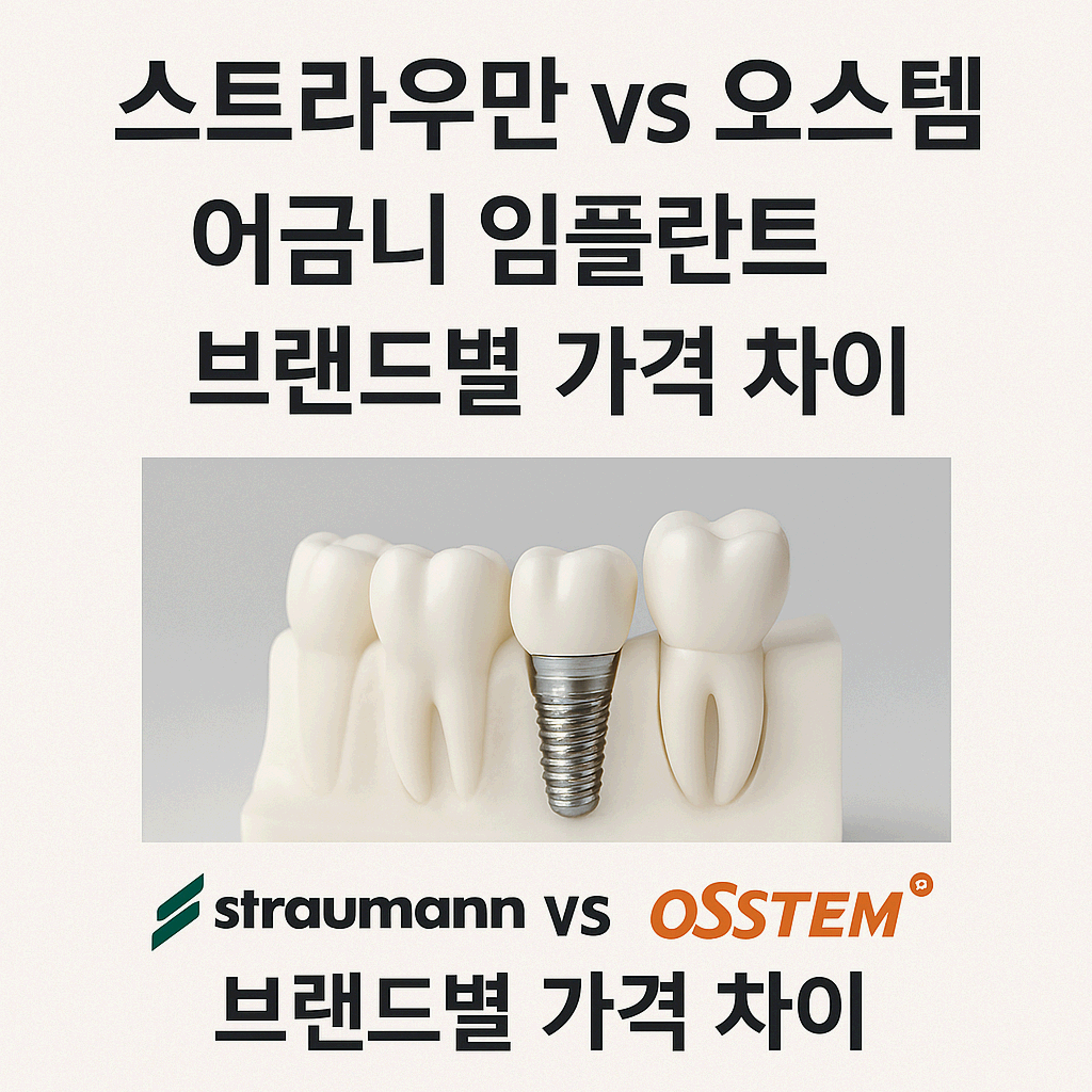 스트라우만 vs 오스템, 어금니 임플란트 브랜드별 가격 차이