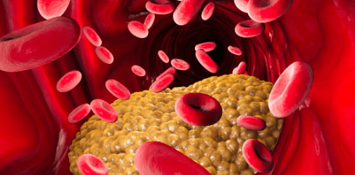 중성지방 낮추는 방법, 중성지방 정상수치