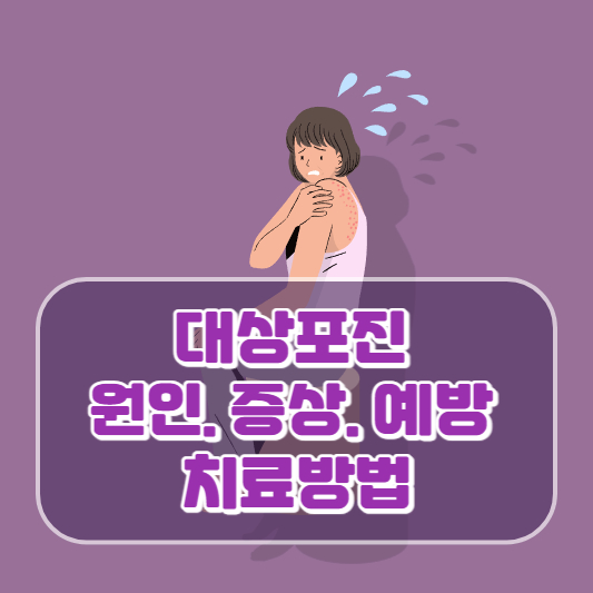 대상포진: 원인, 증상, 예방과 치료방법