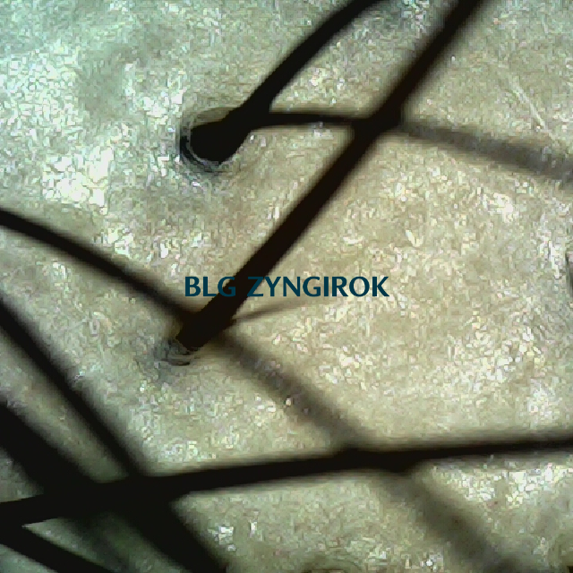 탈모 극복 프로젝트 - 정수리 두피 모습이다.