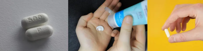 수두 치료