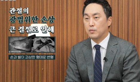 통풍합병증
