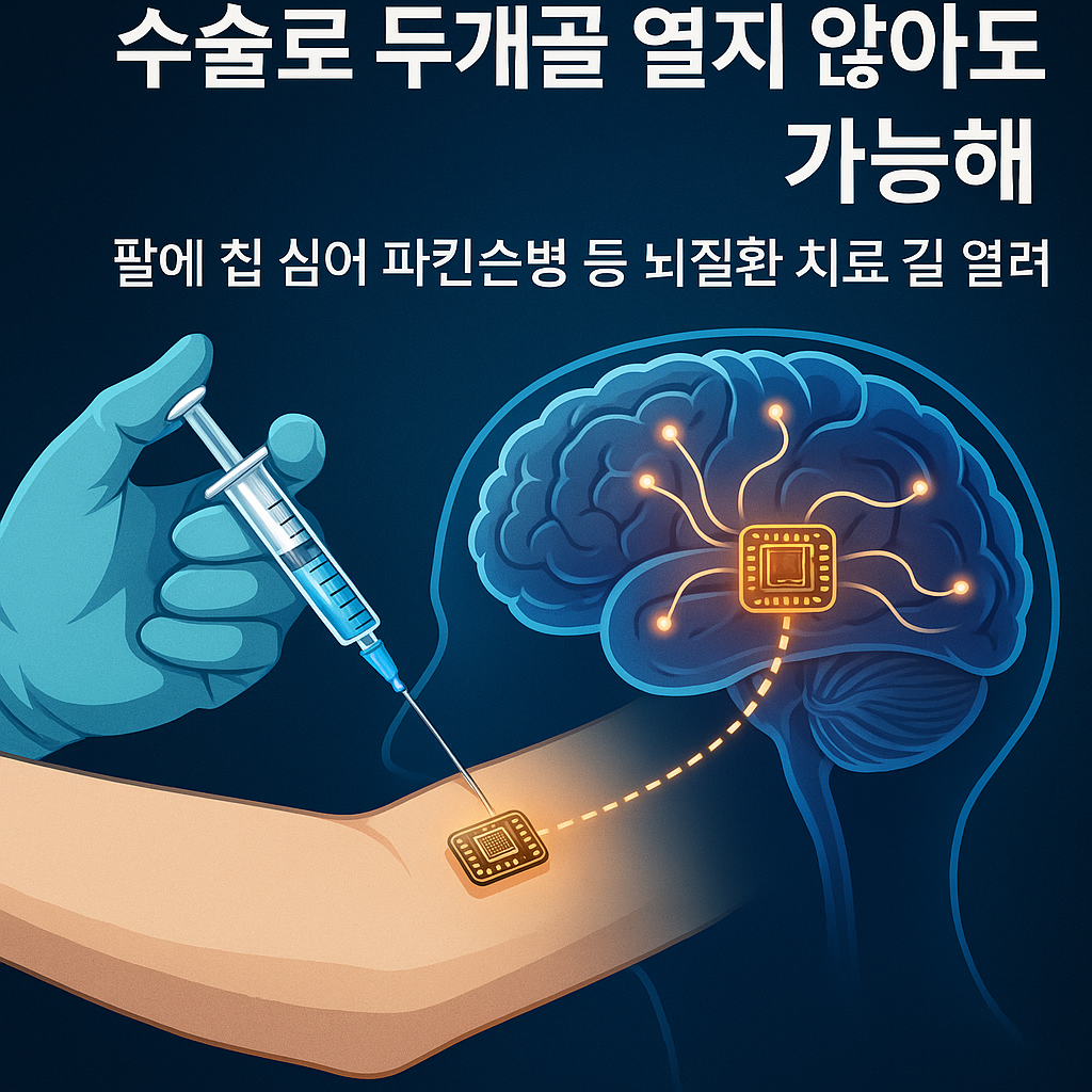 팔에 주사기로 초소형 칩을 주입하는 장면 + 뇌신경 회로 연결 그래픽 ALT: &ldquo;주사로 삽입된 미세 칩이 뇌신경에 연결되는 장면을 형상화한 이미지&rdquo;
