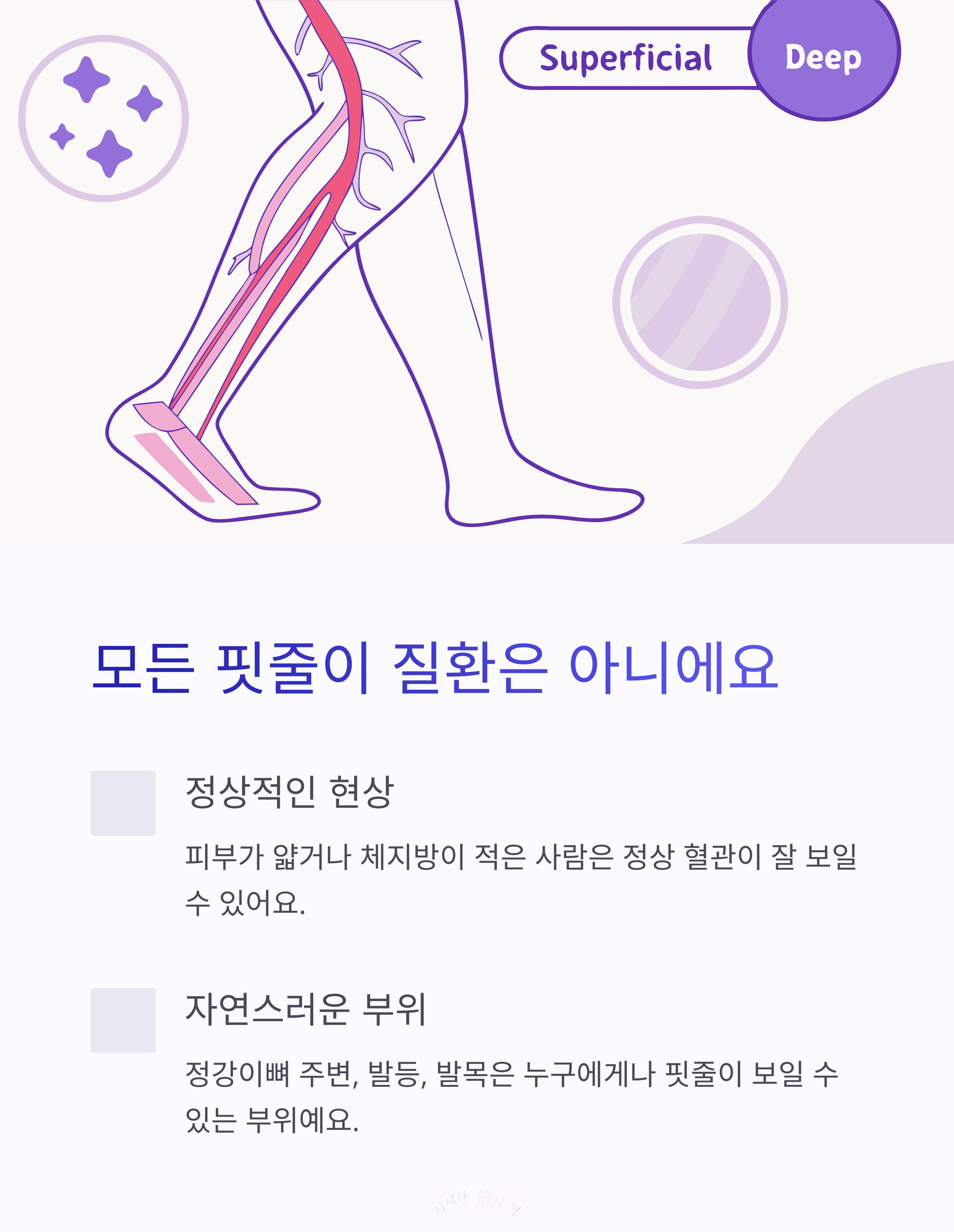 모든 핏줄이 질환은 아니에요