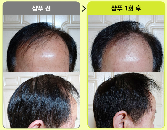 그래비티 샴푸, 모발 볼륨과 탈모 고민을 한 번에 해결!