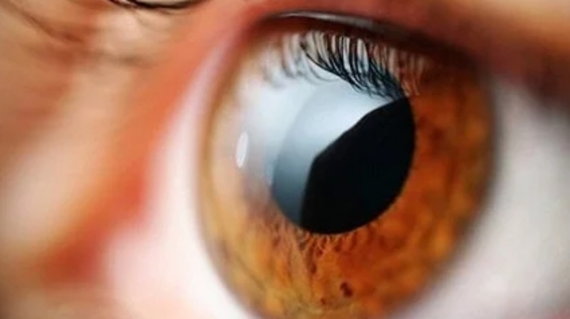 시야가-흐려지는-현상