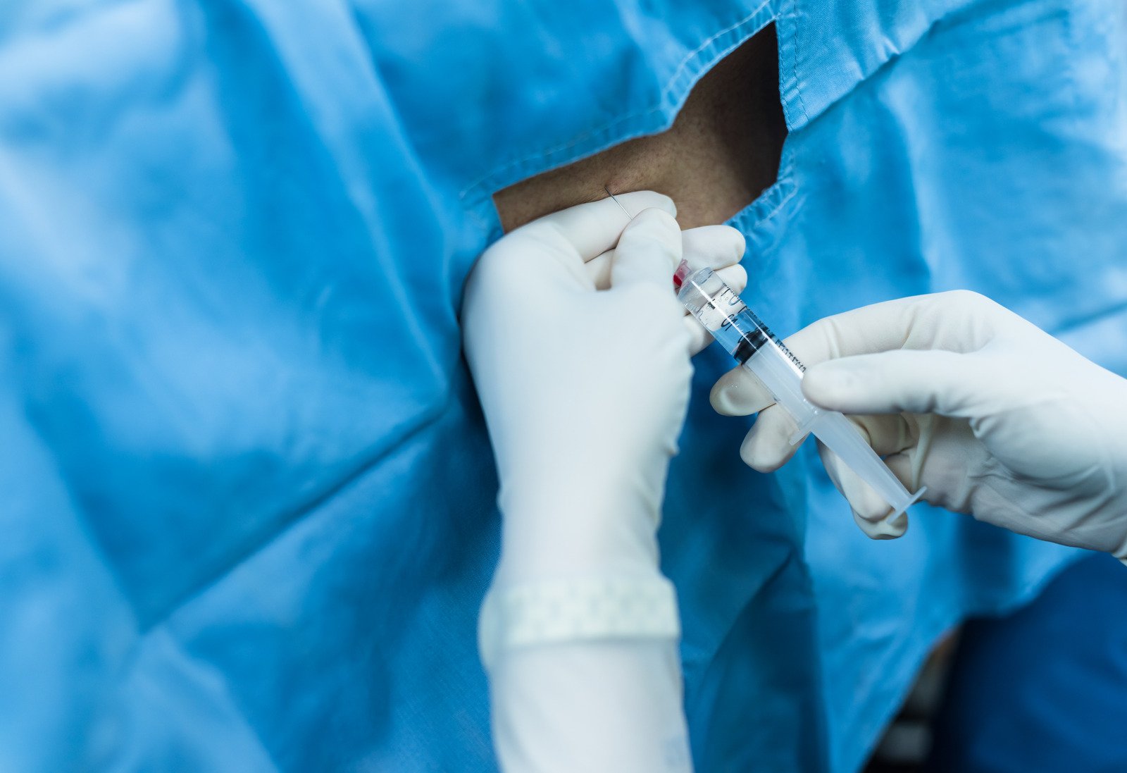 신경차단술(Nerve Block): 스테로이드 주사를 통한 신경 염증 완화 치료