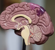 뇌졸중 전조증상 5가지 예방법 원인