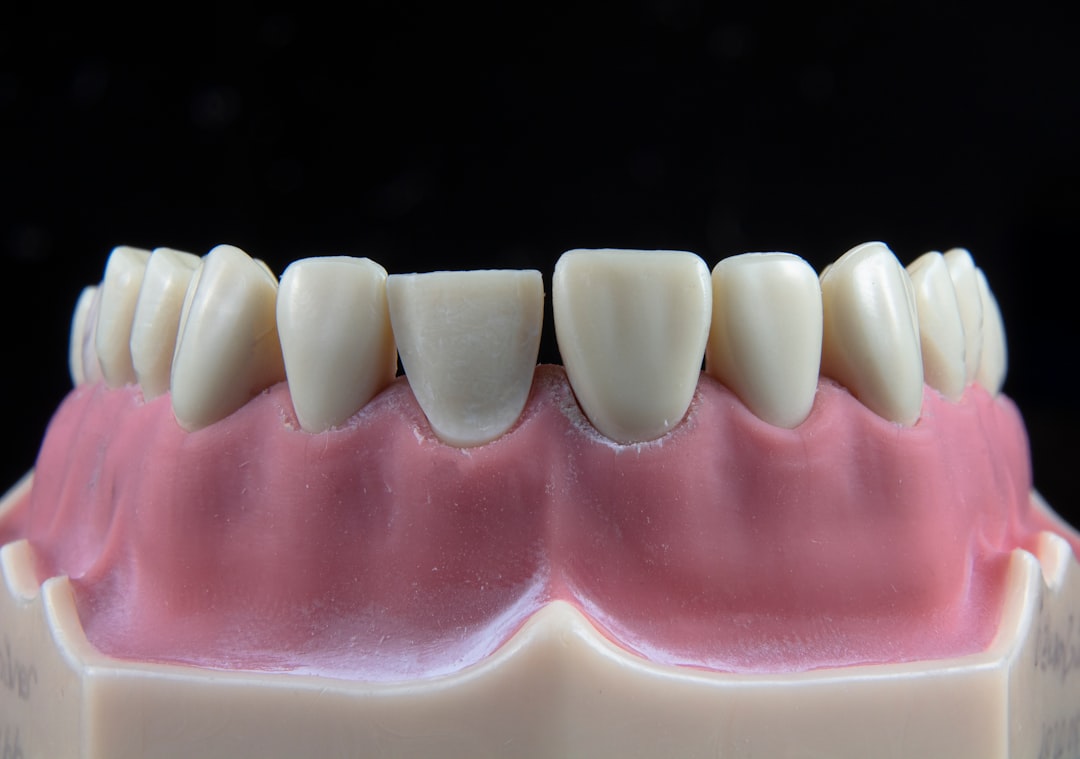 implant