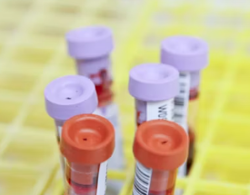 빈혈 증상 원인 치료 방법