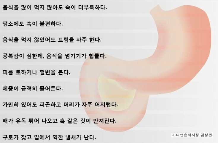 위암 증상/ 출처 - 네이버블로그[가디언손해사정 김성관]