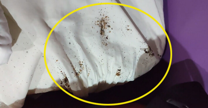 빈대 물린자국 퇴치법, 진드기 물린 후 증상 퇴치법