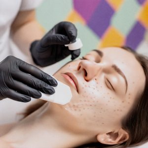 기미 관리 방법