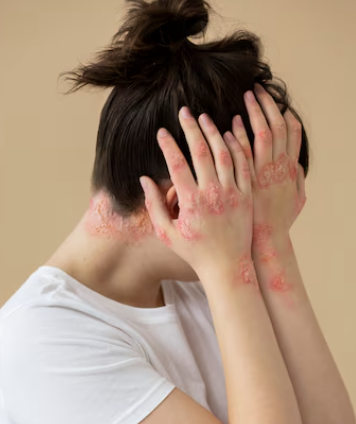 몸이 가려운 이유 8