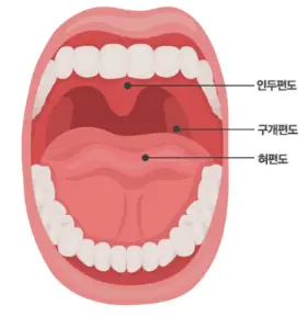 편도위치