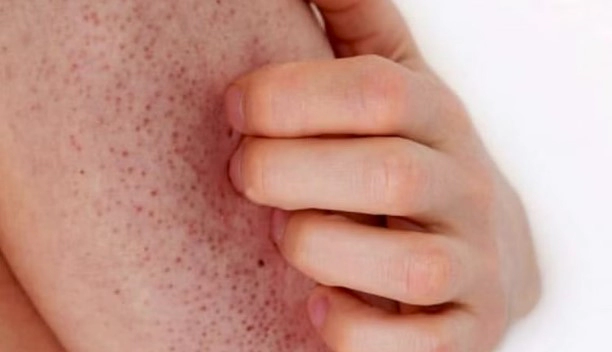 모공각화증 자주묻는질문 FAQ