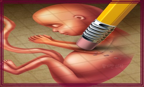 임신 중절 수술 시기