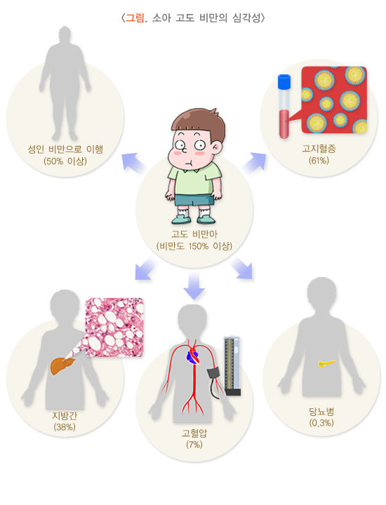 소아비만, 절약유전자, 지방세포증식형, 신호등식단, 성조숙증